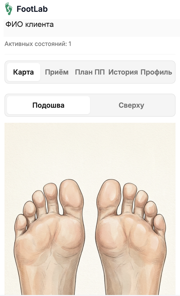 Карта стопы